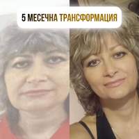 Eterna Drop Anti-age система