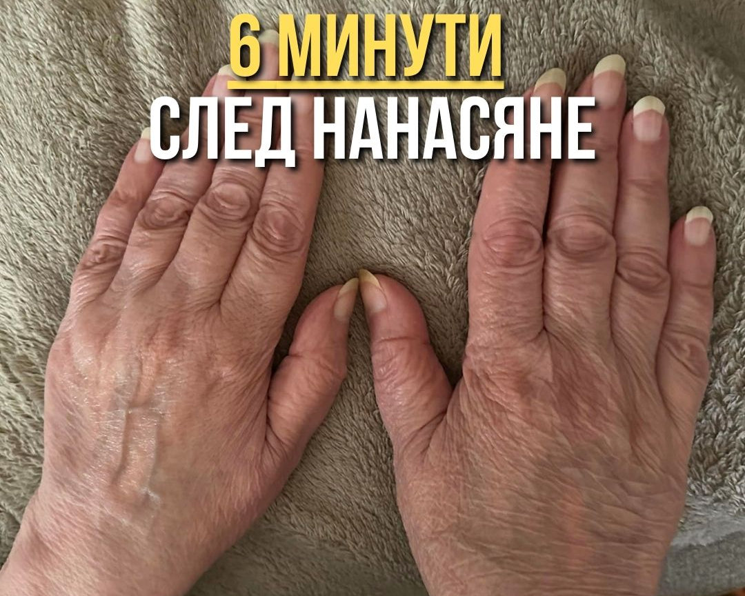Аничка В